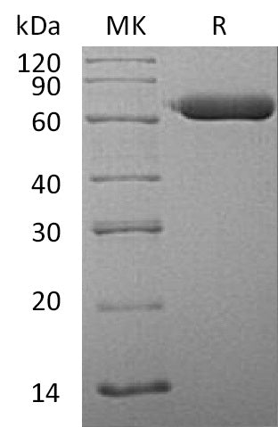 Recombinant Human SGSH (C-6His)
