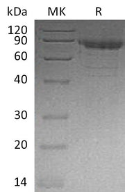 Recombinant Human CDH11 (C-6His)