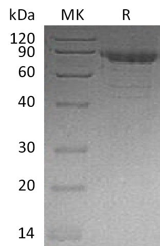 Recombinant Human CDH11 (C-6His)