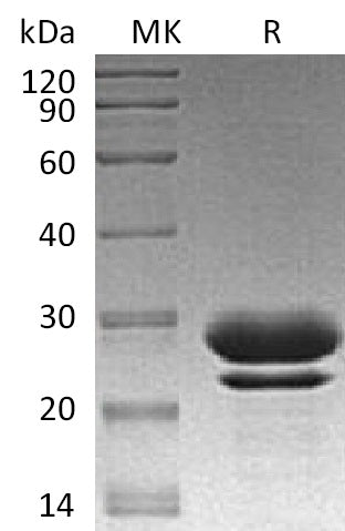 Recombinant Human FKBP7 (C-6His)