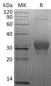 Recombinant Human κ-Casein (C-6His)