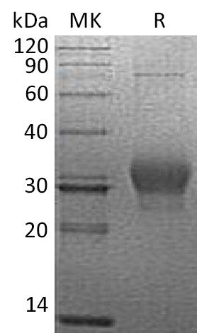 Recombinant Human κ-Casein (C-6His)