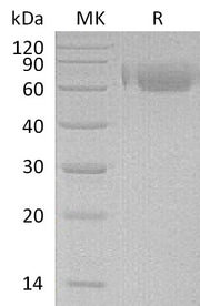 Recombinant Human LILRA2 (C-6His)