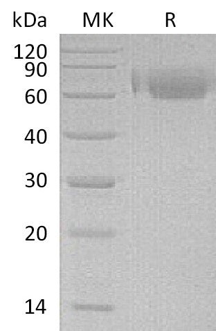 Recombinant Human LILRA2 (C-6His)