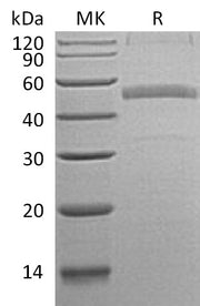 Recombinant Human Calumenin (C-6His)