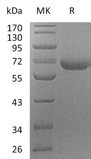 Recombinant Human PRCP (C-6His)