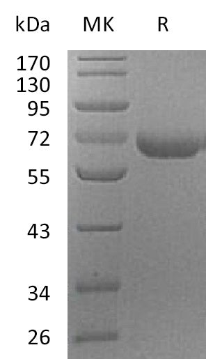 Recombinant Human PRCP (C-6His)