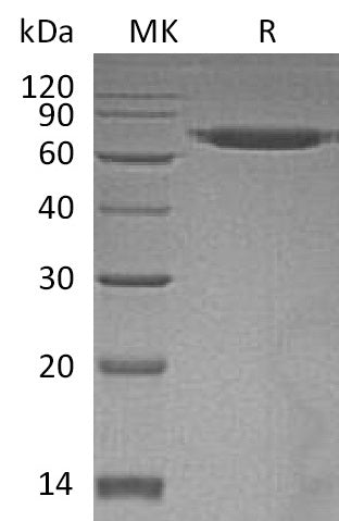 Recombinant Human ERO1L (C-6His)