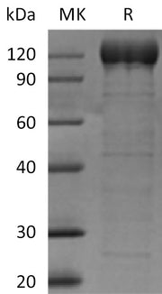 Recombinant Human AOC3 (C-Fc)