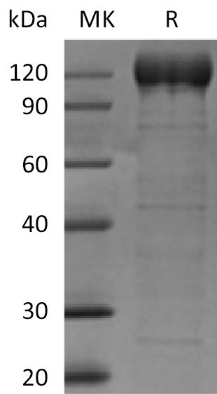 Recombinant Human AOC3 (C-Fc)