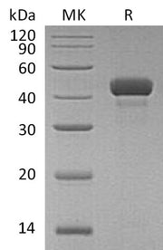 Recombinant Human RCN3 (C-6His)