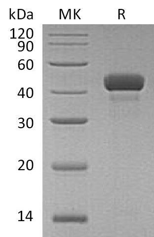 Recombinant Human RCN3 (C-6His)