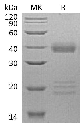 Recombinant Human IGFBP-5 (C-6His)