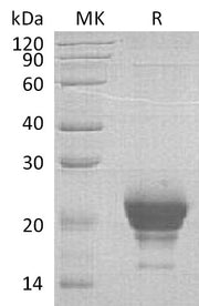 Recombinant Human RNASE 6 (C-6His)