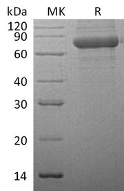 Recombinant Human TPP1 (C-6His)