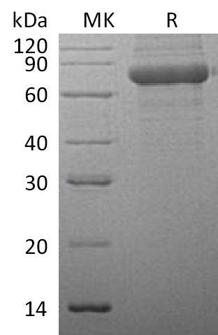 Recombinant Human TPP1 (C-6His)