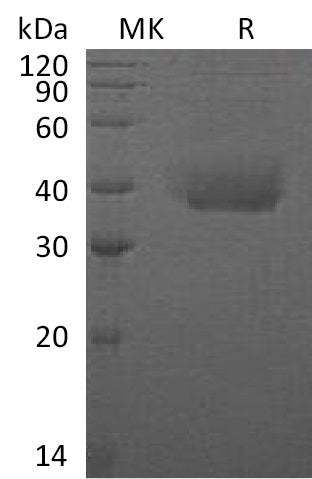Recombinant Human ANTXR1 (C-6His)
