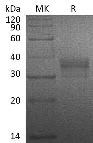 Recombinant Human NTAL (C-6His)