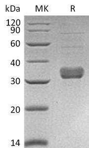 Recombinant Mouse Collectin-11 (C-6His)