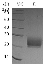 Recombinant Human CD94 (N-6His)