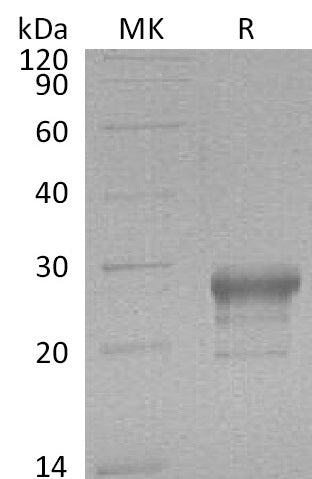 Recombinant Human PTGDS (C-6His)