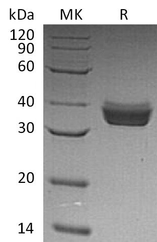 Recombinant Human ERP27 (C-6His)