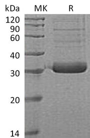 Recombinant Human Collectin-11 (C-6His)
