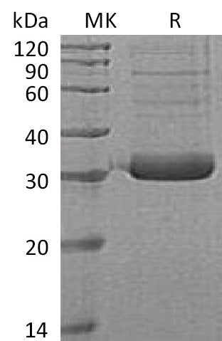 Recombinant Human Collectin-11 (C-6His)