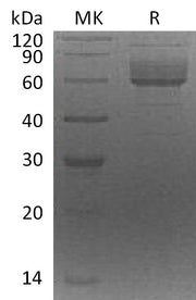 Recombinant Human CLUL1 (C-6His)