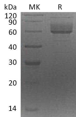Recombinant Human CLUL1 (C-6His)