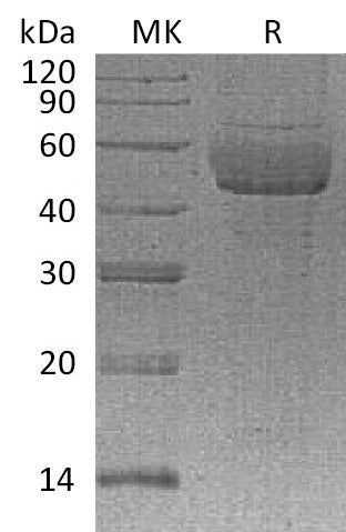 Recombinant Human SDC1 (C-6His)