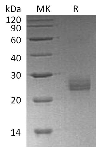 Recombinant Human Ephrin-A1 (C-6His)