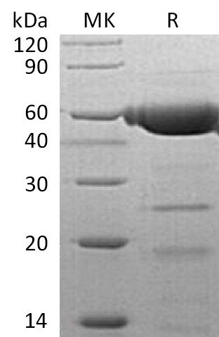 Recombinant Human PLRP2 (C-6His)