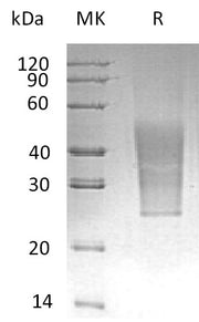 Recombinant Human CD99L2 (C-6His)
