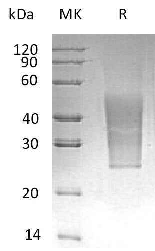Recombinant Human CD99L2 (C-6His)