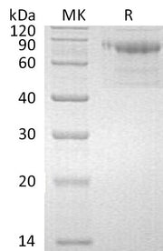 Recombinant Human Serpin A10 (C-6His)