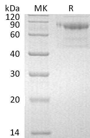 Recombinant Human Serpin A10 (C-6His)