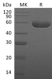 Recombinant Human HYAL1 (C-6His)