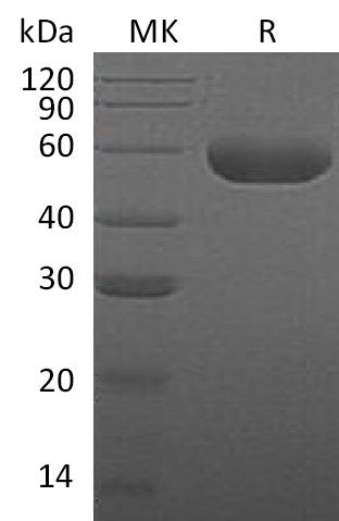 Recombinant Human HYAL1 (C-6His)