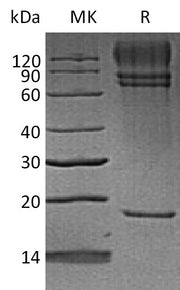 Biotinylated Human PCSK9 (C-8His-HA-Avi)