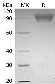 Recombinant Human NLGN4X (C-6His)
