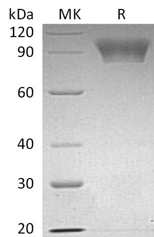 Recombinant Human NLGN4X (C-6His)