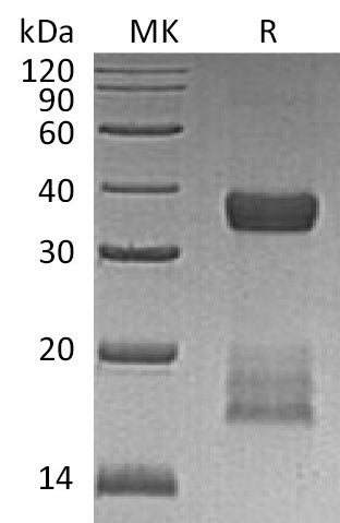 Recombinant Human CGREF1 (C-6His)