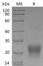 Recombinant Human BST2 (C-6His)