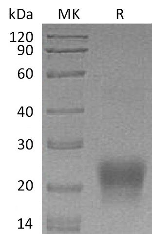 Recombinant Human BST2 (C-6His)