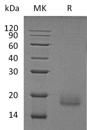 Recombinant Human ACVR1 (C-6His)