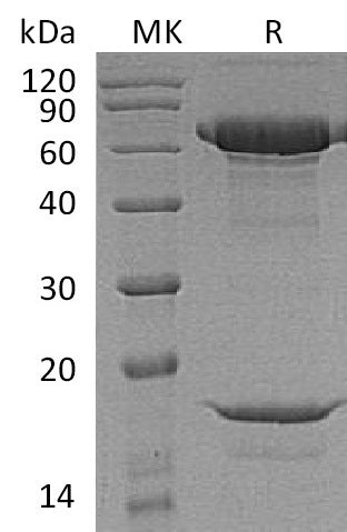Recombinant Macaca nemestrina PCSK9 (C-6His)