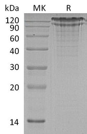 Recombinant Human LDL R (C-6His)