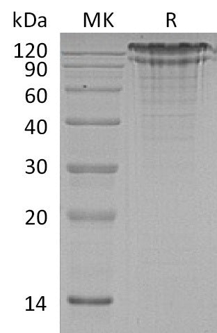 Recombinant Human LDL R (C-6His)