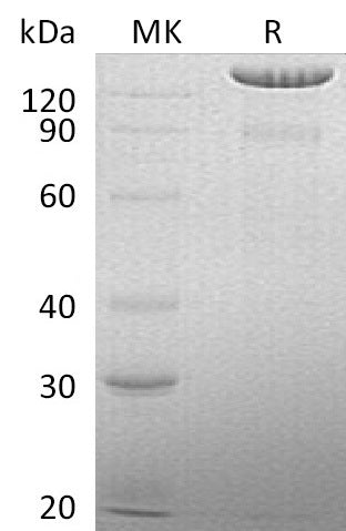 Recombinant Human BCAN (C-6His)